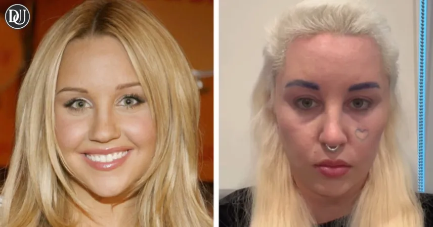 Amanda Bynes Uses Ozempic 